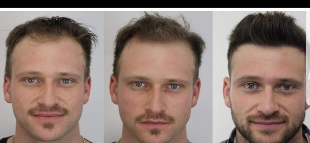 Image #1 from mmorin_1904