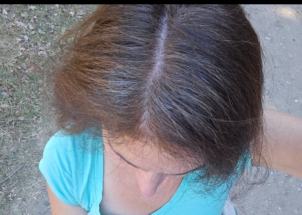 Image #2 from stit60