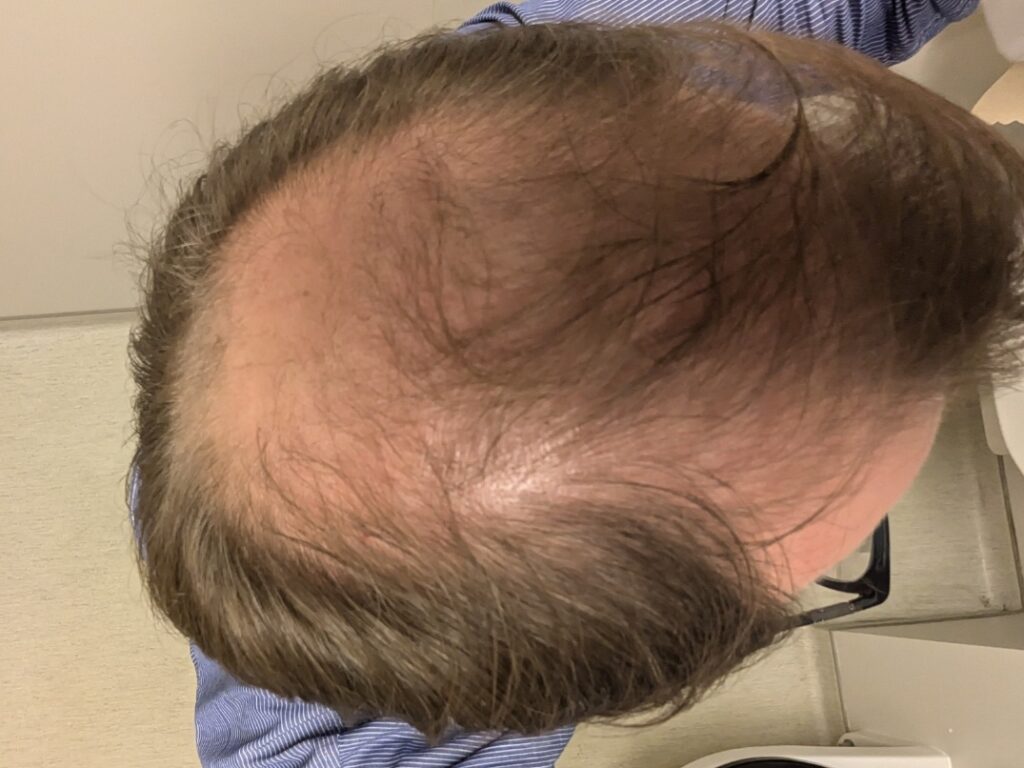 Image #1 from Edward