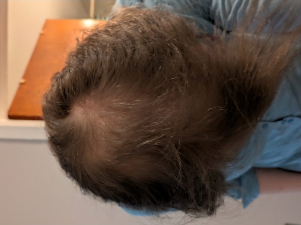 Image #2 from Edward