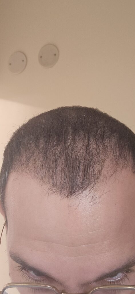 Image #3 from Adi Damti