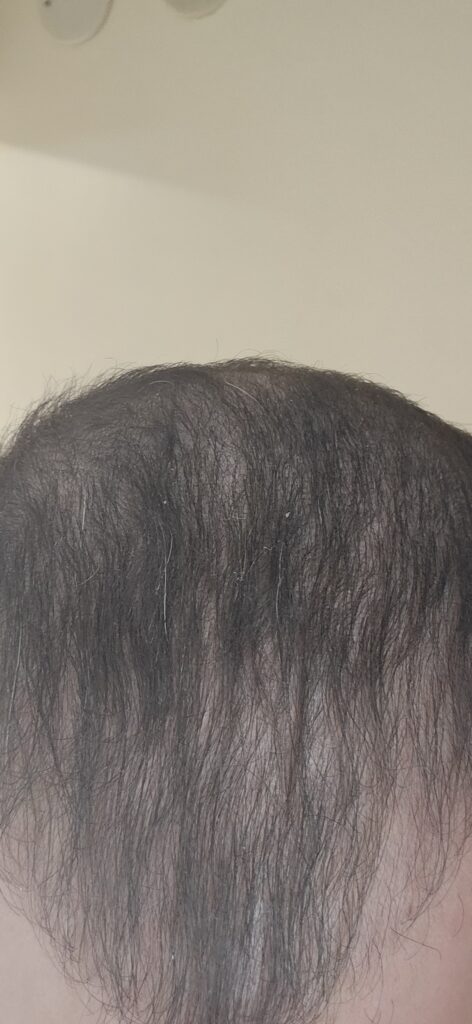 Image #4 from Adi Damti