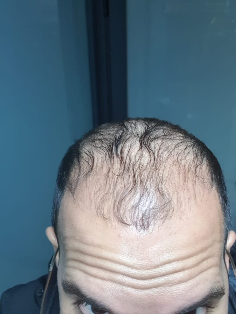 Image #1 from Adi Damti