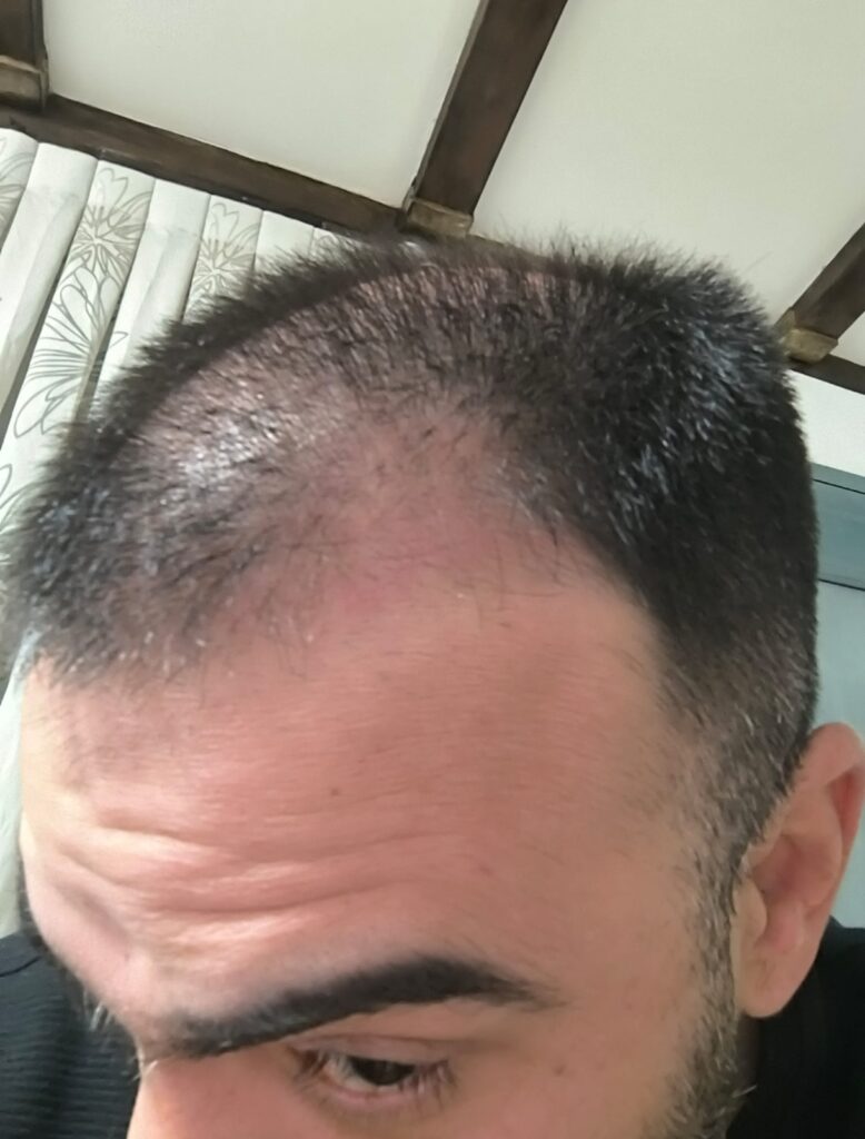 Image #1 from Yossi