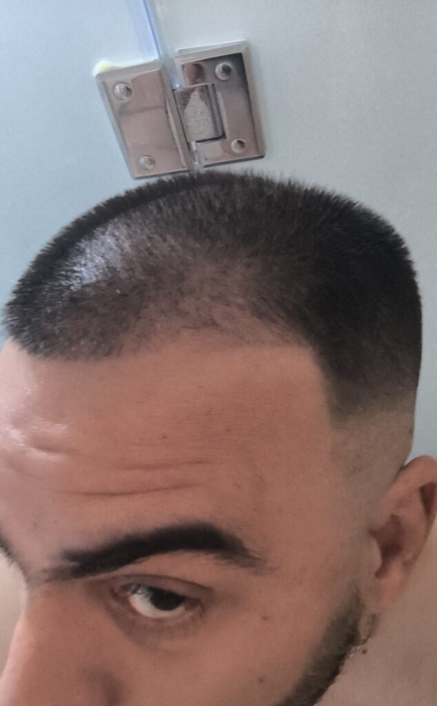 Image #2 from Yossi