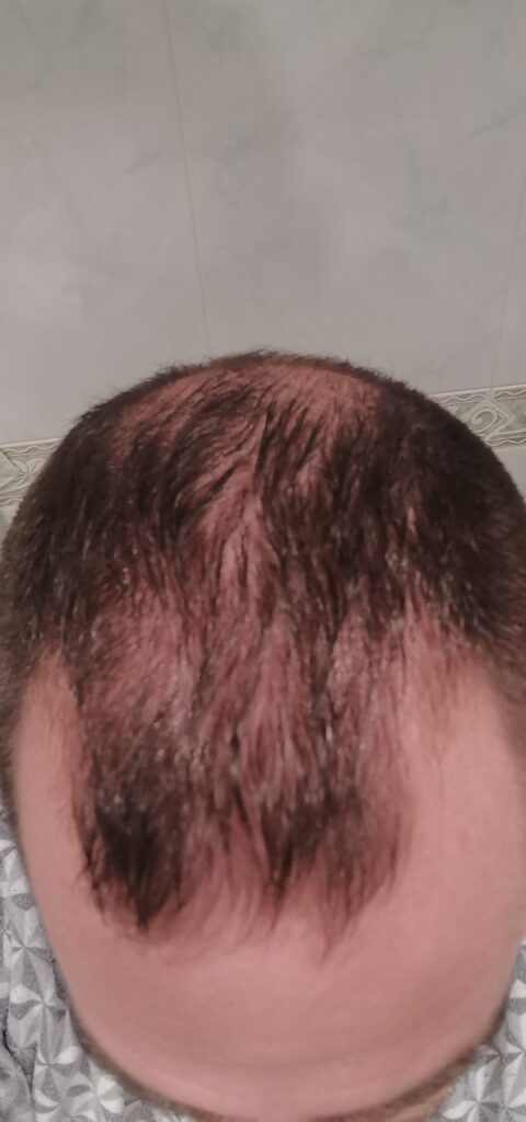 Image #1 from Victor