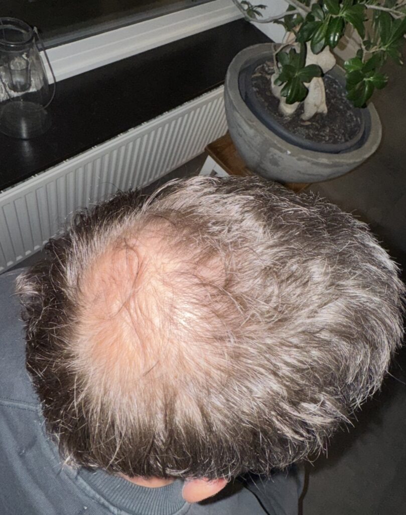 Image #1 from Fterhoeven