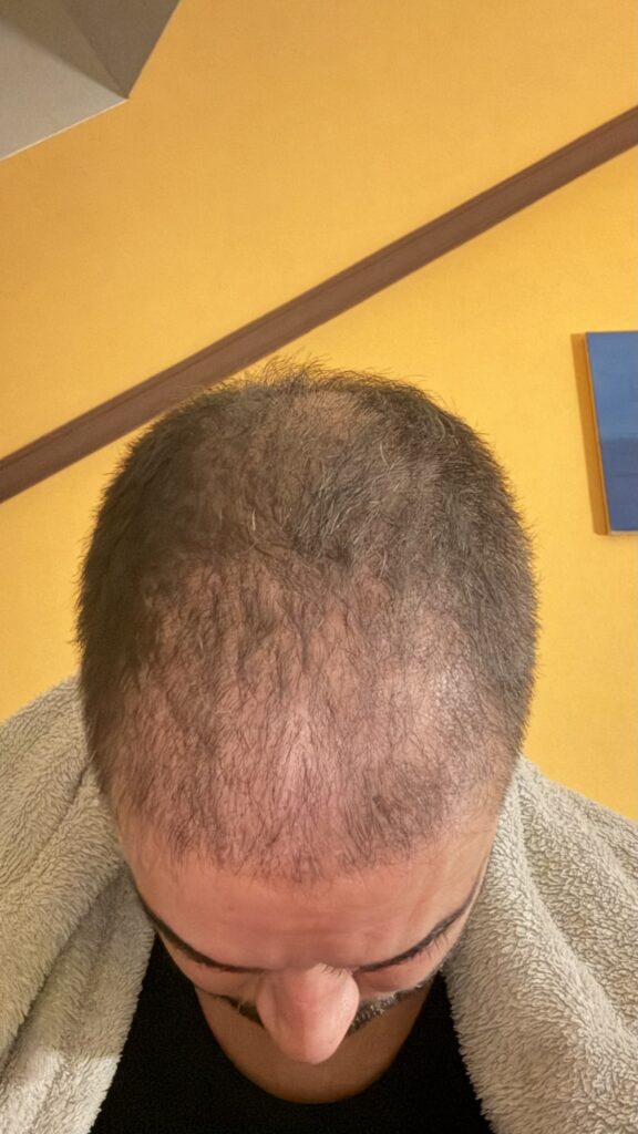 Image #1 from Iván Lourido pérez