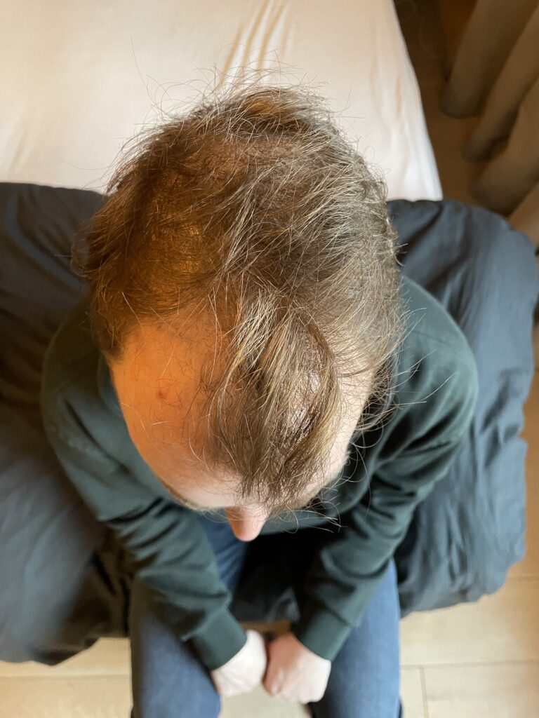 Image #2 from Frank