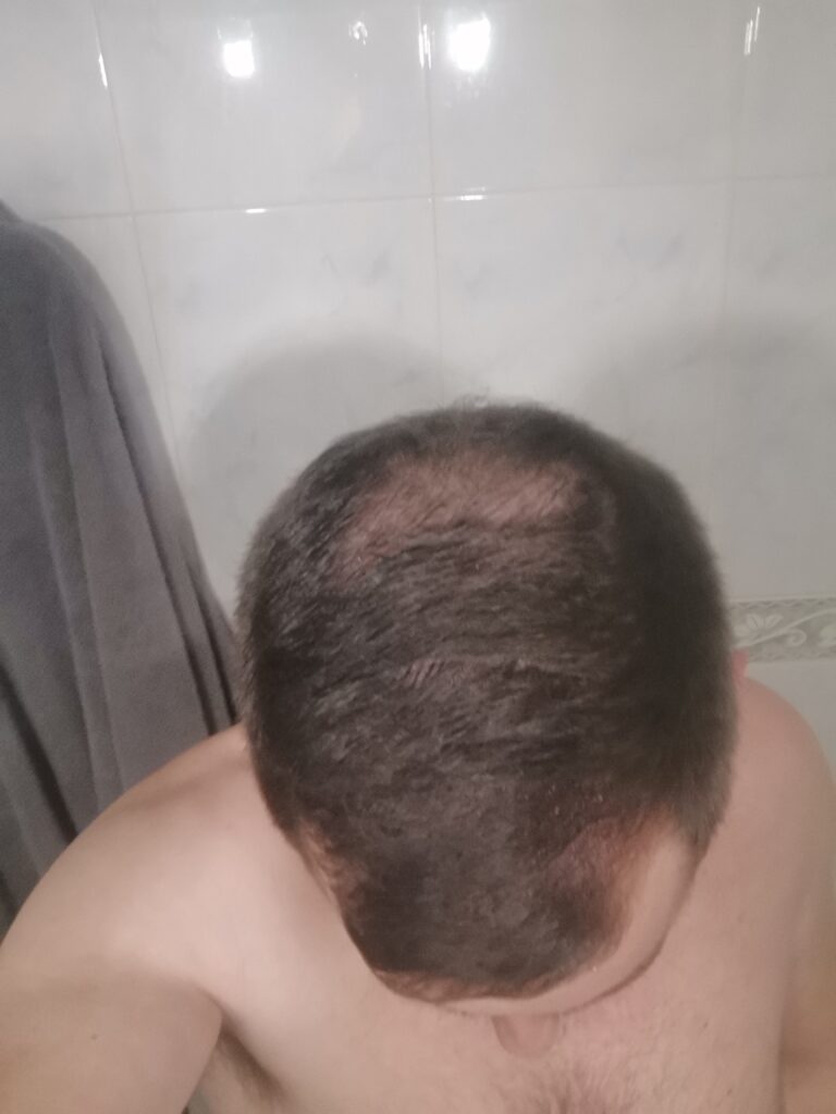 Image #2 from Victor