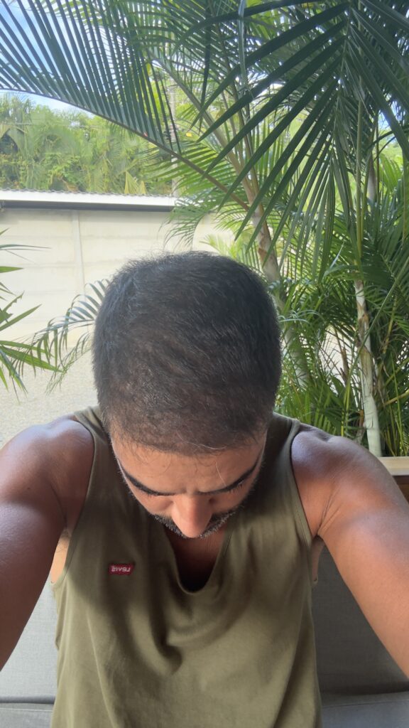 Image #2 from Iván Lourido pérez