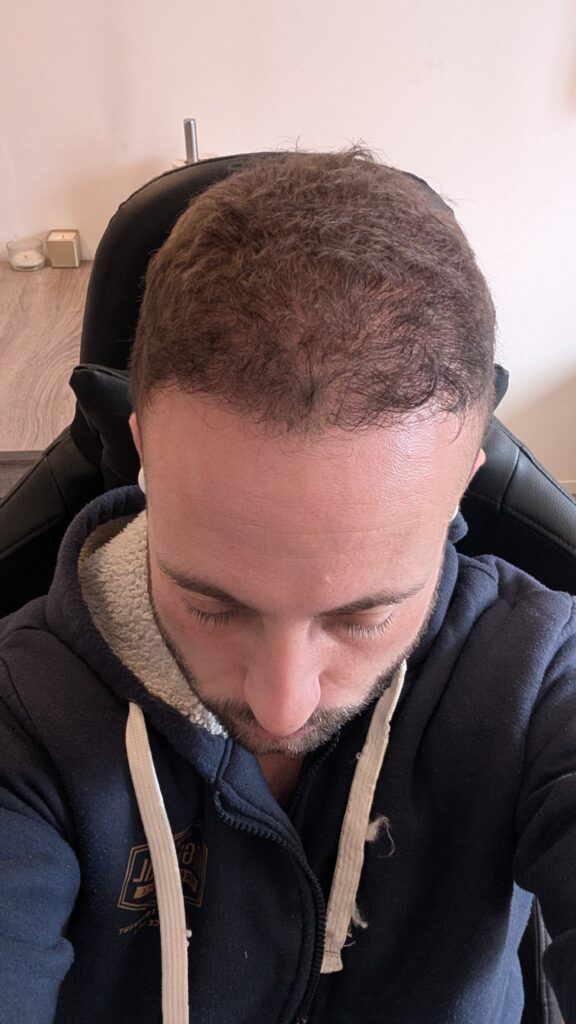 Image #2 from yairjakten_45117