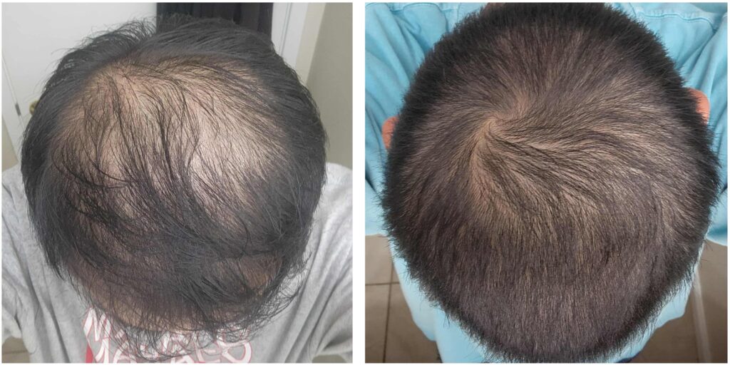 Image #1 from bigbadwolfcry